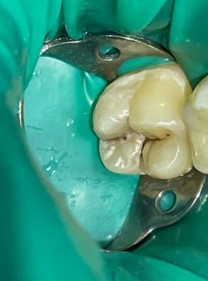 Подростковая стоматология фото до