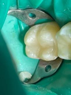 Подростковая стоматология фото после