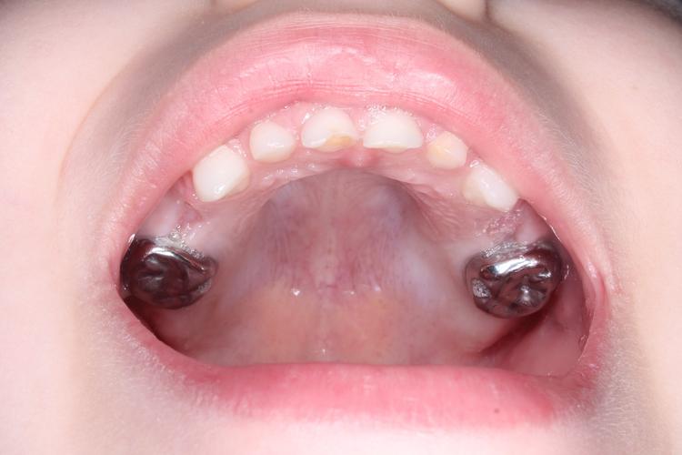 Лечение в условиях наркоза фото после